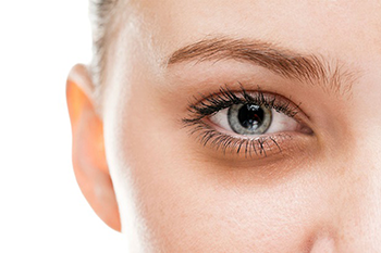 Treatments for under eye circle